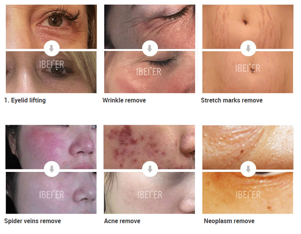 Medical Grade Peels Medical Grade Peels