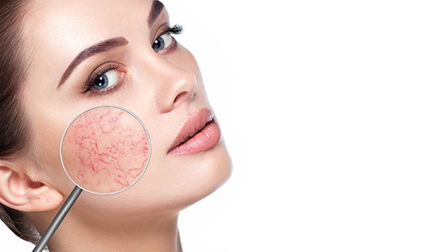 Laser Skin Rejuvenation Laser Skin Rejuvenation